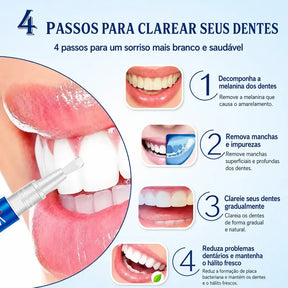 Caneta Para Clareamento Dental Removedor Manchas - FlashPen