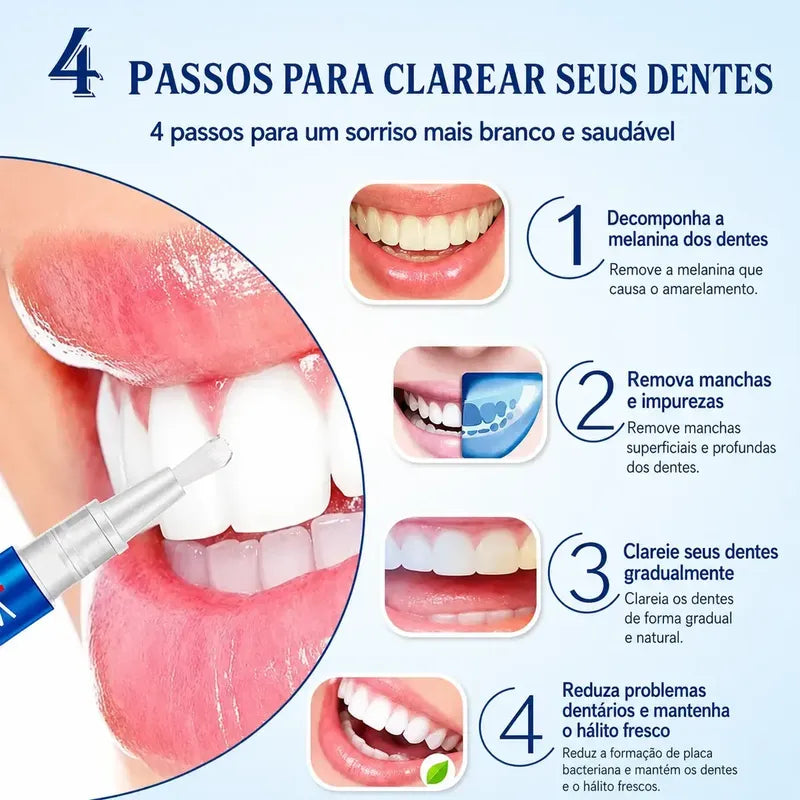 Caneta Para Clareamento Dental Removedor Manchas - FlashPen