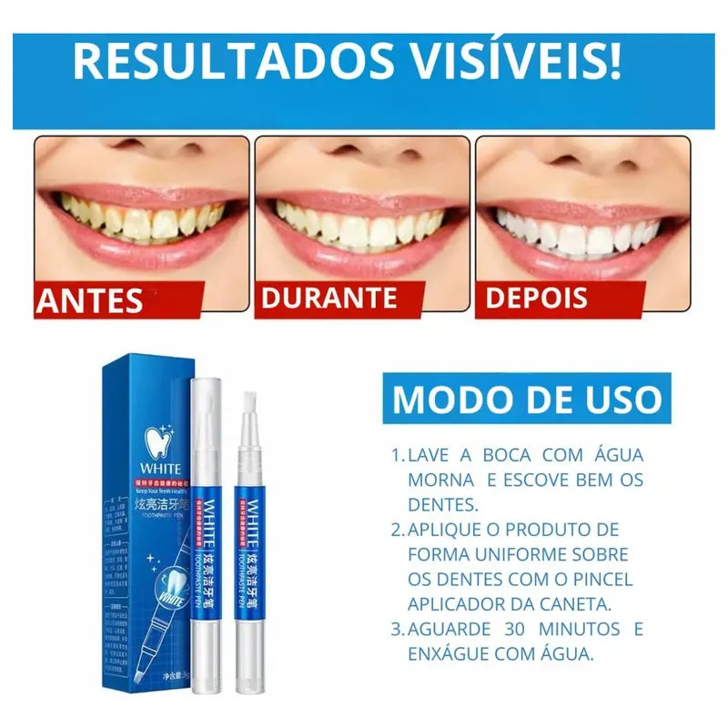 Caneta Para Clareamento Dental Removedor Manchas - FlashPen
