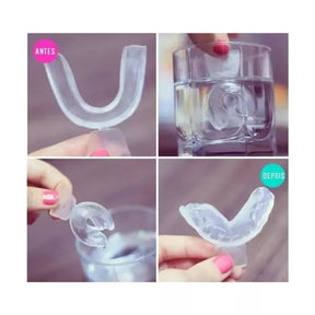 Clareador Dental Whiteness Simple 22% - 3 Un + 1 Par de Moldeiras