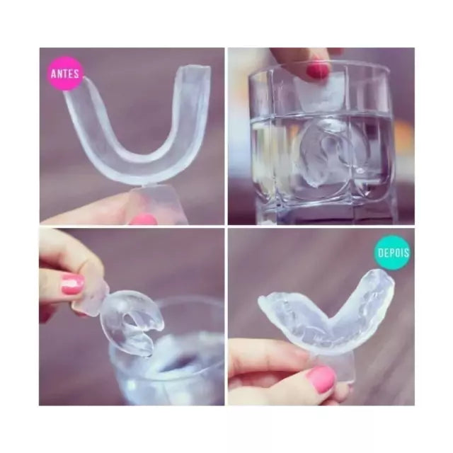 Clareador Dental Whiteness Simple 22% - 3 Un + 1 Par de Moldeiras